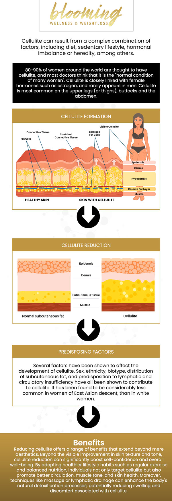 Cellulite Reduction treatments are designed to smooth and reduce the appearance of cellulite, giving you smoother, firmer skin. Using advanced techniques, Dr. Anjmun Sharma targets stubborn areas of fat and skin texture, improving the overall look and feel of your skin. For more information, contact us or book an appointment online. We are conveniently located at 10701 Melody Dr Suite 305, Northglenn, CO 80234. Cellulite Reduction treatments are designed to smooth and reduce the appearance of cellulite, giving you smoother, firmer skin. Using advanced techniques, Dr. Anjmun Sharma targets stubborn areas of fat and skin texture, improving the overall look and feel of your skin. For more information, contact us or book an appointment online. We are conveniently located at 10701 Melody Dr Suite 305, Northglenn, CO 80234.
